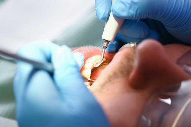 Best Emergency Treatment for Jaw Pain or Injury in Mount Penn, PA
